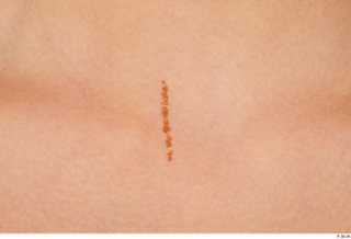 Suleika birthmarks skin 0001.jpg